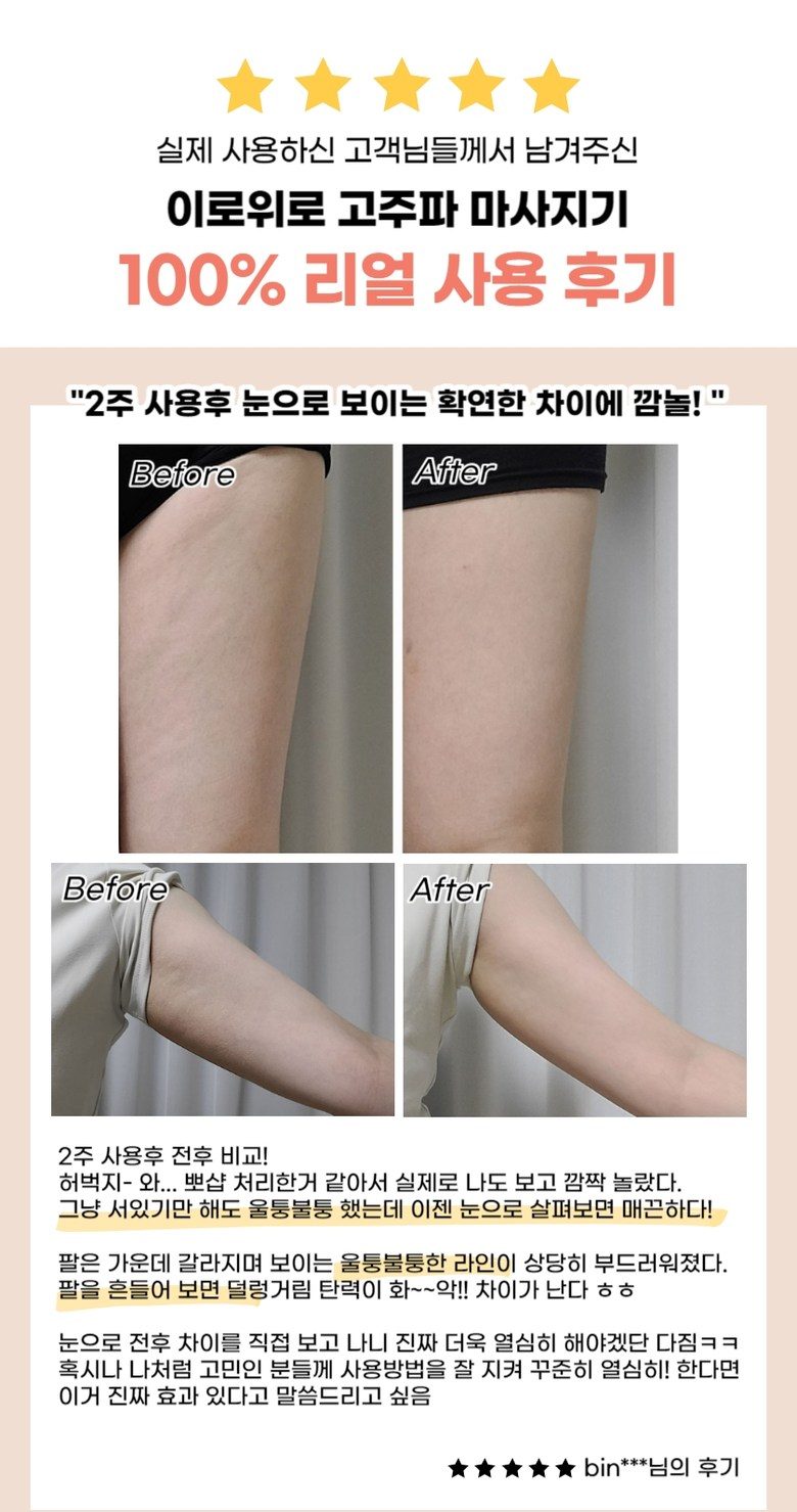 이로위로 바디 고주파 마사지기 온열 갈바닉 초음파 바본관리 가정용고주파기 홈케어 뷰티디바이스