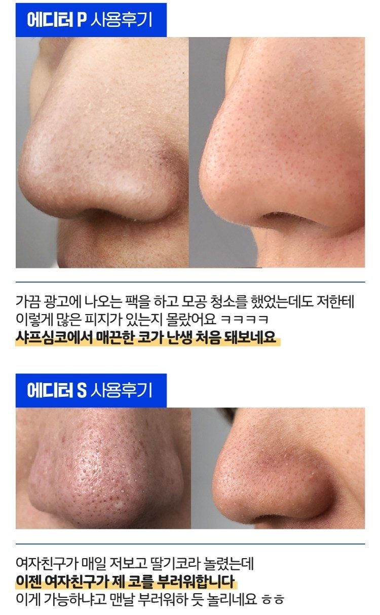 국산 아쿠아필링기 얼굴 코 피지 제거 워터필링 초음파 각질제거기 라벨르L8